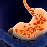 Outcomes after treatment with proton pump inhibitors in patients with ineffective esophageal motility: A systematic review