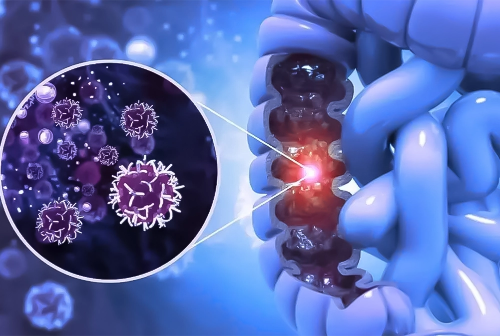 Germline variants in patients from the Iranian hereditary colorectal cancer registry