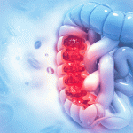 Potential Drug Targets for Colorectal Cancer Prevention