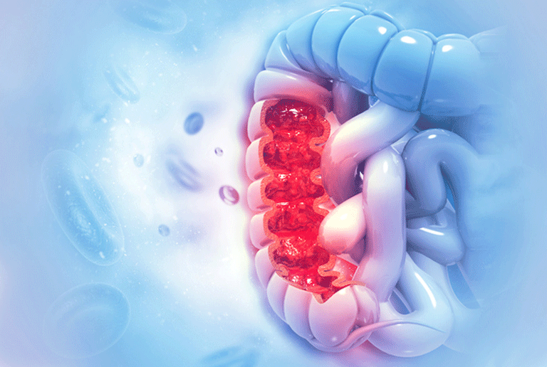 Potential Drug Targets for Colorectal Cancer Prevention