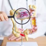 MUC1-Driven Guanylin Gene Delivery via Succinylated PEI- 9 Nanocarrier for Colorectal Cancer Treatment