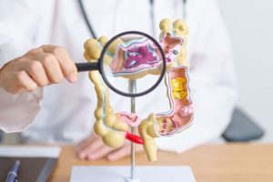 MUC1-Driven Guanylin Gene Delivery via Succinylated PEI- 9 Nanocarrier for Colorectal Cancer Treatment