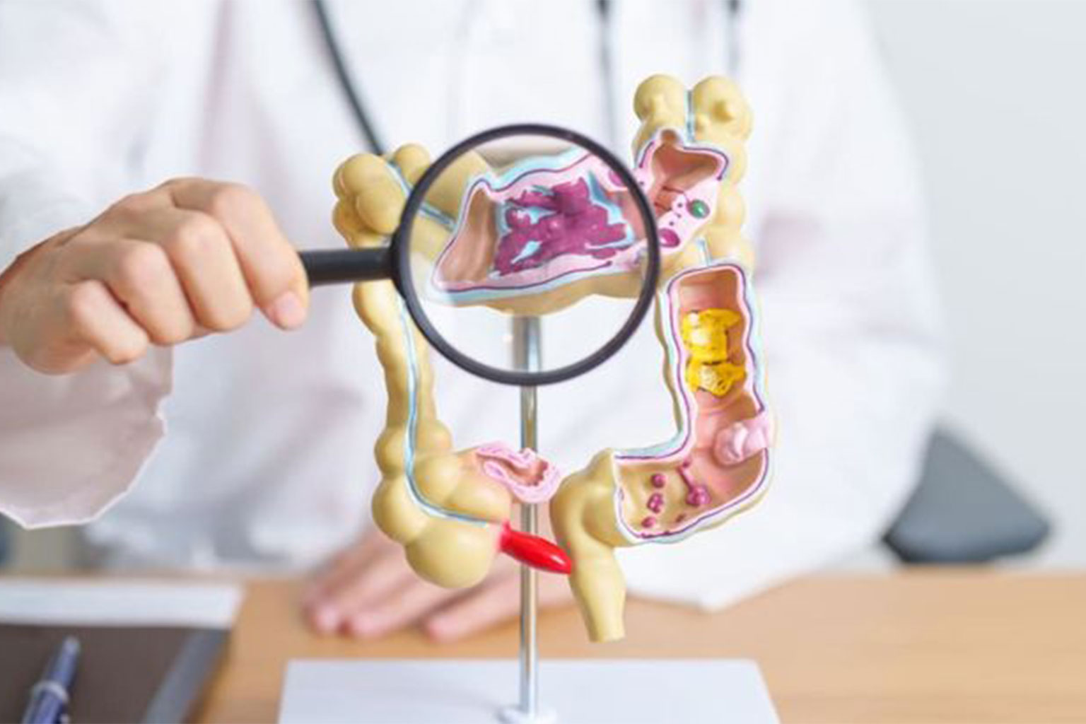 MUC1-Driven Guanylin Gene Delivery via Succinylated PEI- 9 Nanocarrier for Colorectal Cancer Treatment